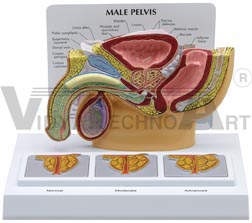 Male Pelvis with 3D Prostate Frame